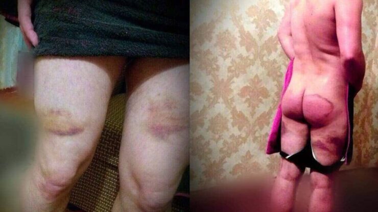 Dette er bilder av homofile voldsofre - den russiske ambassaden i Oslo mener det ikke finnes bevis