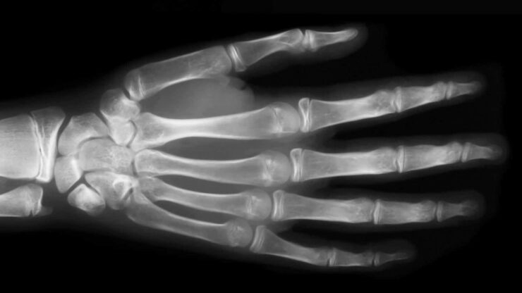 Hvor gammel er asylsøkeren? Nytt verktøy kan fortsatt ikke gi et nøyaktig svar